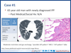 Translating IPF Clinical Trials to Real Life Patients: A Case-Based Symposium