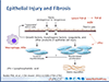 Facing IPF Together: A Case-Based Team Approach to Managing IPF